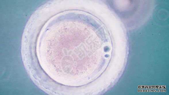 哪里可以代孕吗,怎么查是不是多囊卵巢？多囊卵